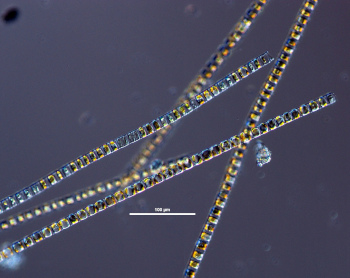 Source: https://www.eoas.ubc.ca/research/phytoplankton/diatoms/centric/skeletonema/images/full/S_costatum_20xDIC_full.jpg
