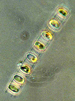 Skeletonema image from web page http://www.glerl.noaa.gov/seagrant/GLWL/Algae/Diatoms/Cards/Skeletonema.html